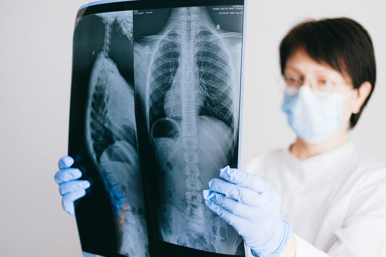 radiologist holding x ray film of spine